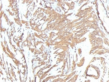 ACTA2 Antibody Cocktail / Alpha Actin