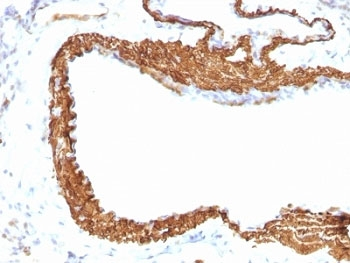 ACTA2 Antibody Cocktail / Alpha Actin