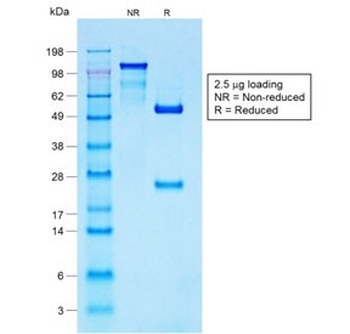 S100B Antibody