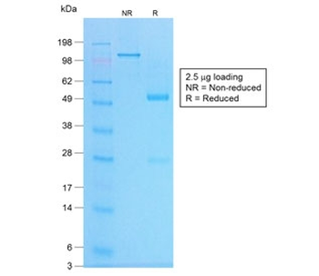 Chromogranin A Antibody