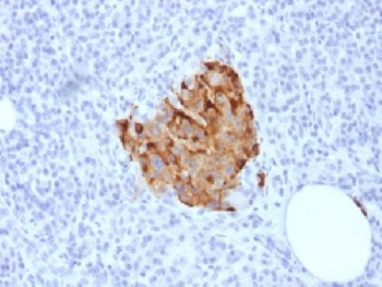 Chromogranin A Antibody