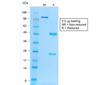 EpCAM Antibody