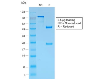 PMEL17 / Melanoma gp100 Antibody