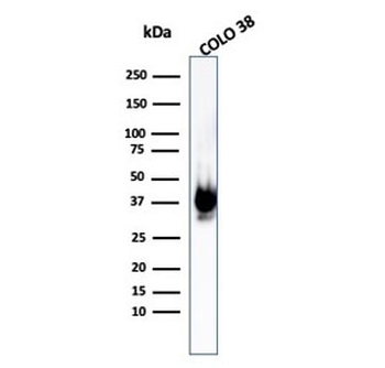 PMEL17 / Melanoma gp100 Antibody