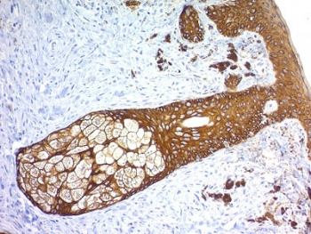 Basic Cytokeratin Antibody