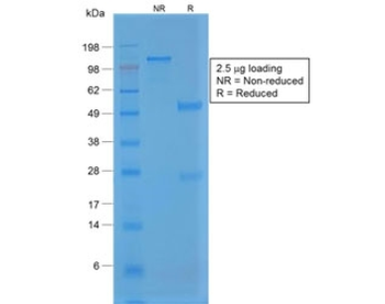 von Willebrand Factor Antibody / vWF