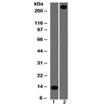 von Willebrand Factor Antibody / vWF