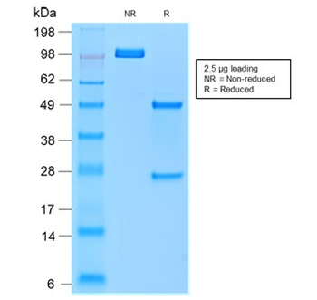 TRAcP Antibody / TRAP / ACP5