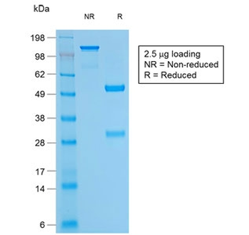 Bcl-2 Antibody