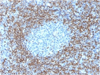 Bcl-2 Antibody