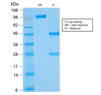 Bcl-2 Antibody