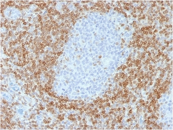 Bcl-2 Antibody