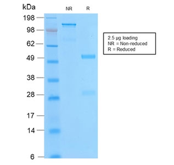 Bcl-2 Antibody