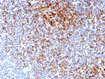 Bcl-2 Antibody