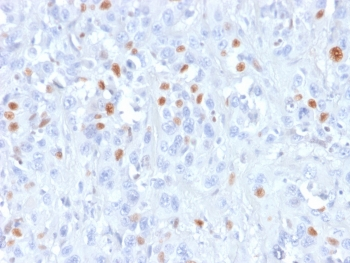 p21 Antibody / CDKN1A