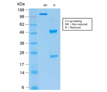 p21 Antibody / CDKN1A