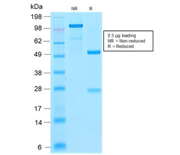 p21 Antibody / CDKN1A