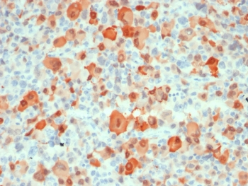 S100B Antibody