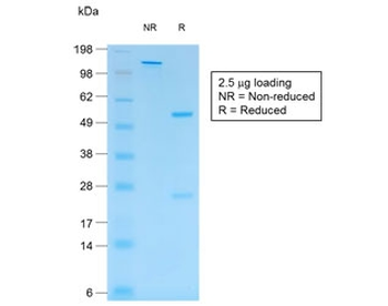 S100B Antibody