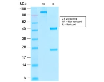 Thrombomodulin Antibody / CD141