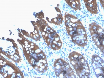 KRT8 Antibody / Cytokeratin 8