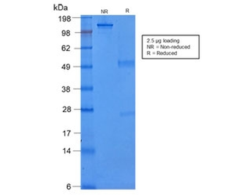 KRT8 Antibody / Cytokeratin 8