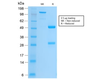 Integrin beta 3 Antibody / ITGB3 / CD61