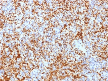 Integrin beta 3 Antibody / ITGB3 / CD61