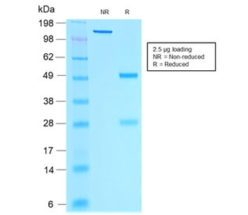 Estrogen Receptor alpha Antibody