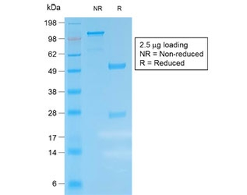 Kappa Light Chain Antibody