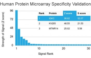 Kappa Light Chain Antibody