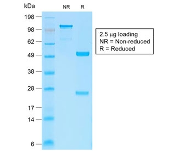 Beta Catenin Antibody