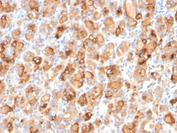 TG Antibody / Thyroglobulin