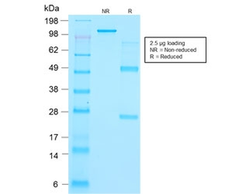 TG Antibody / Thyroglobulin