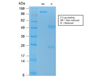 TNFSF15 Antibody / VEGI / TL1A