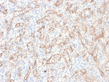 TNFSF15 Antibody / VEGI / TL1A