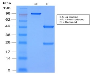 MMP3 Antibody / Matrix Metalloproteinase 3