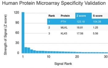 Parathyroid Hormone Antibody / N Terminal