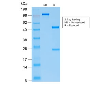 Parathyroid Hormone Antibody / N Terminal