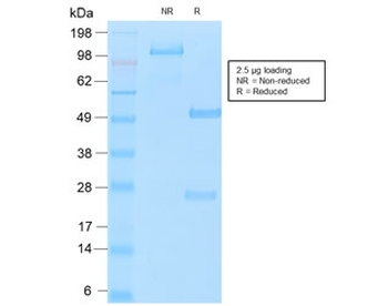 MUC16 Antibody / CA125