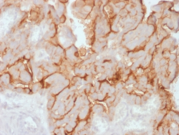 MUC16 Antibody / CA125