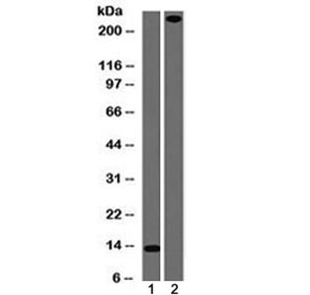 von Willebrand Factor Antibody / vWF