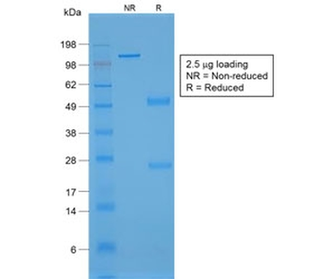 von Willebrand Factor Antibody / vWF