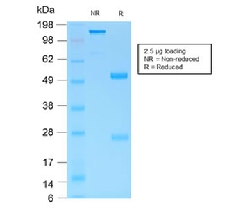 MUC6 Antibody / Gastric Mucin