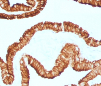 KRT7 Antibody / Cytokeratin 7