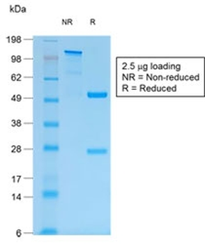 MUC1 Antibody / Mucin-1