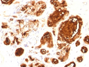 MUC1 Antibody / Mucin-1