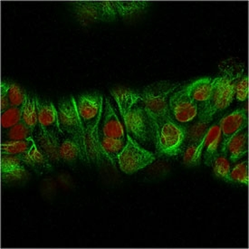 Basic Cytokeratin Antibody