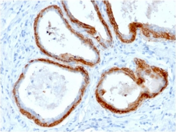 Basic Cytokeratin Antibody