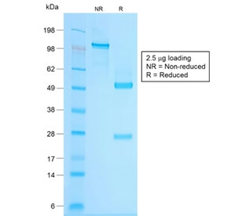 Chromogranin A Antibody